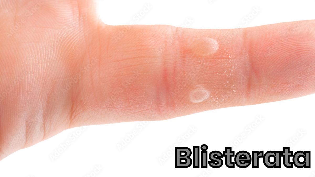 blisterata